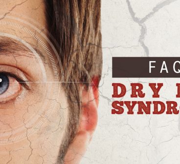 FAQ: Dry Eye Syndrome
